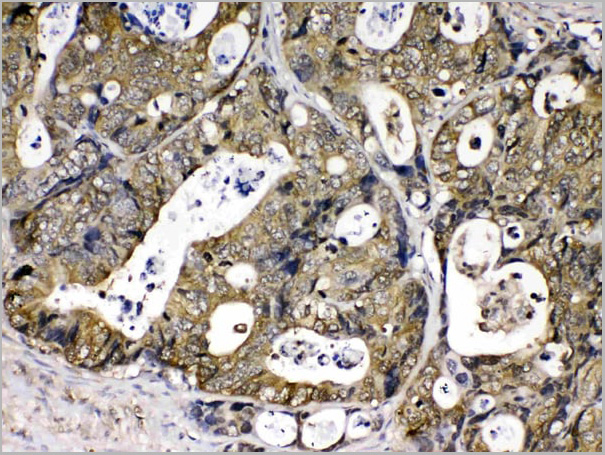 product-image-AAA19148_IHC4.jpg