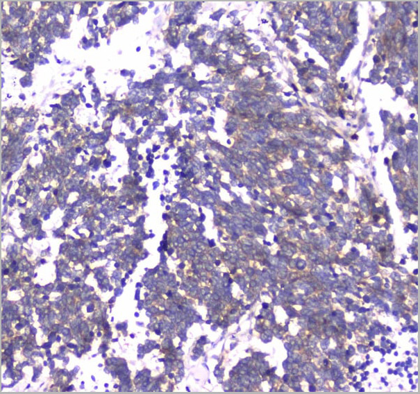 product-image-AAA19152_IHC2.jpg
