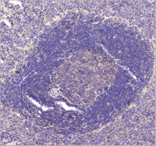 product-image-AAA19152_IHC5.jpg