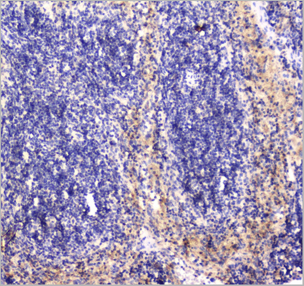 product-image-AAA19152_IHC6.jpg