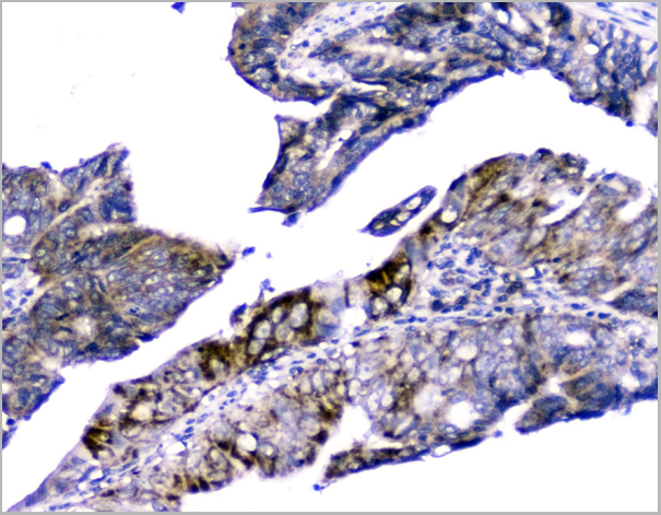product-image-AAA19187_IHC5.jpg