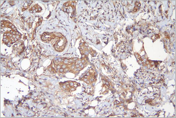 product-image-AAA19200_IHC3.jpg