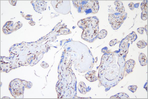 product-image-AAA19200_IHC4.jpg
