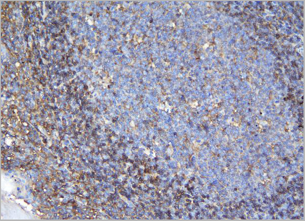 product-image-AAA19200_IHC5.jpg