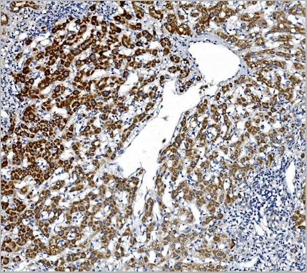 product-image-AAA19201_IHC4.jpg