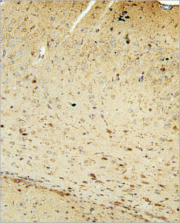 product-image-AAA19206_IHC5.jpg