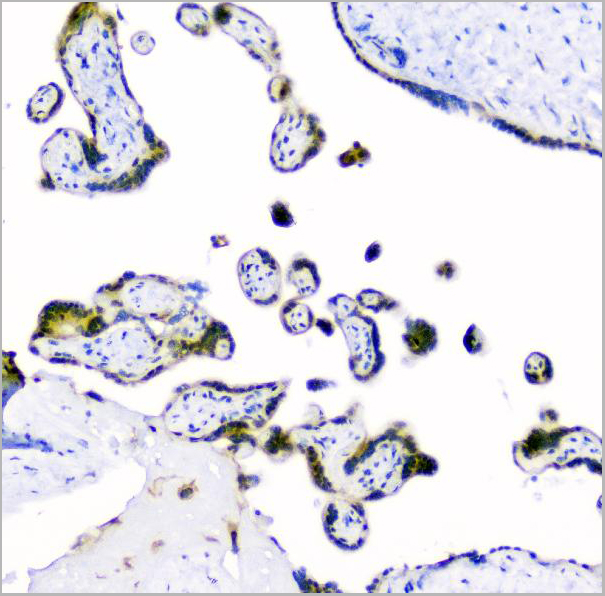 product-image-AAA19210_IHC3.jpg