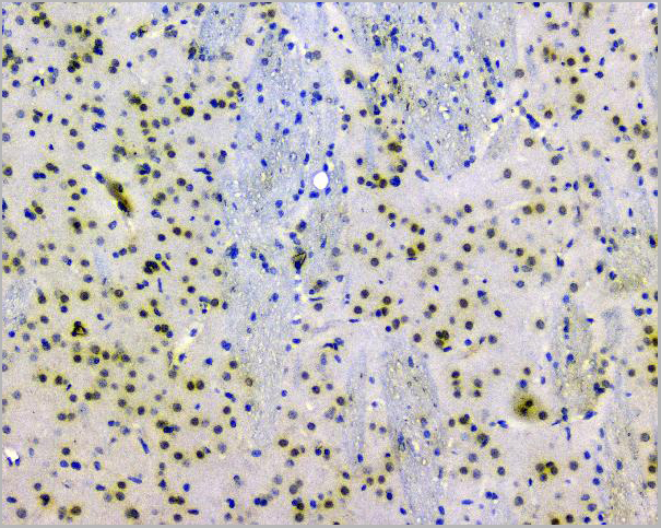 product-image-AAA19210_IHC5.jpg