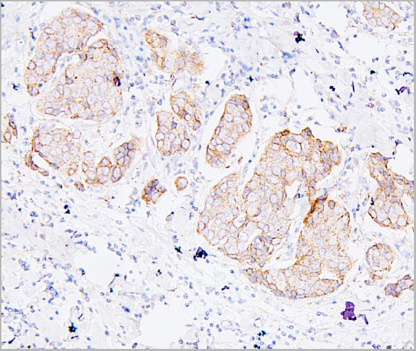 product-image-AAA19212_IHC3.jpg