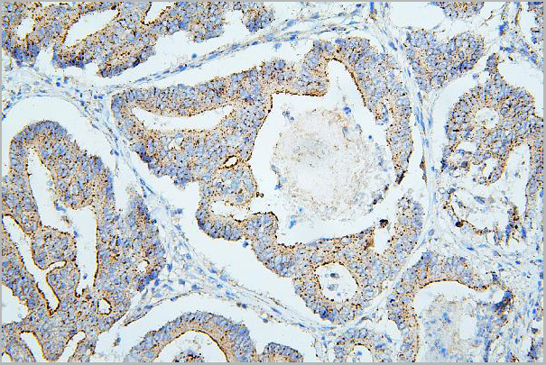 product-image-AAA19212_IHC5.jpg