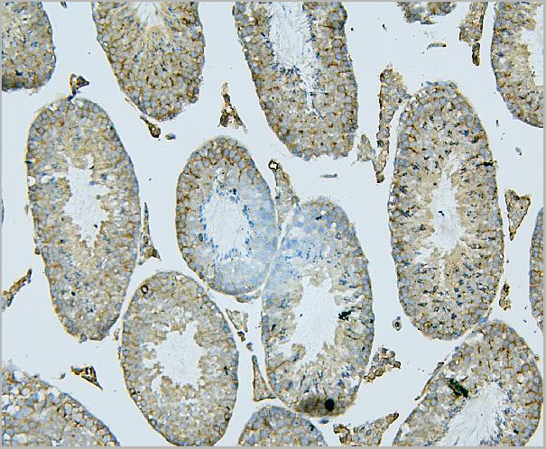 product-image-AAA19212_IHC6.jpg