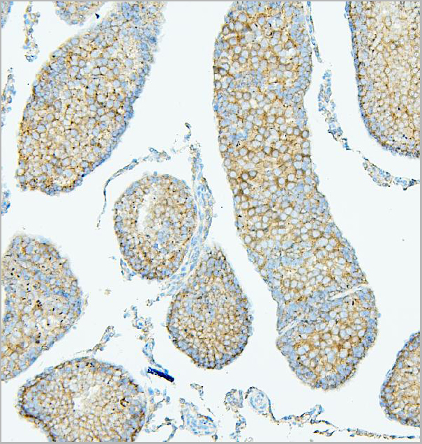 product-image-AAA19212_IHC8.jpg