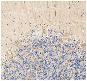 Rabbit Anti-SHANK3 Polyclonal Antibody – Cat# AAA19237 – IHC (Immunohistochemistry)