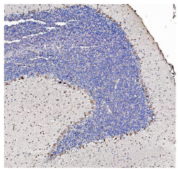 Rabbit Anti-SHANK3 Polyclonal Antibody – Cat# AAA19237 – IHC (Immunohistochemistry)