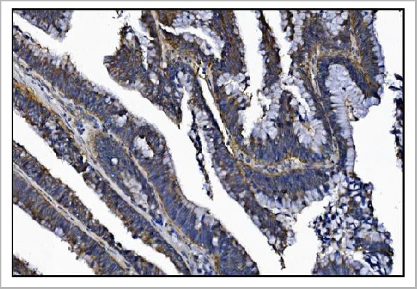 product-image-AAA19238_IHC4.jpg