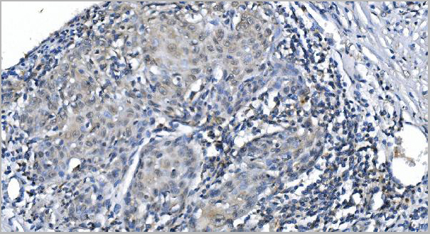 product-image-AAA19247_IHC2.jpg