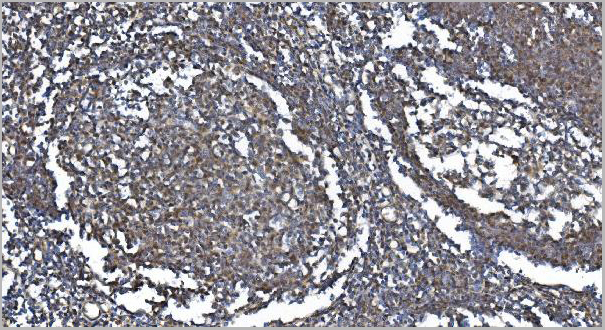 product-image-AAA19247_IHC3.jpg