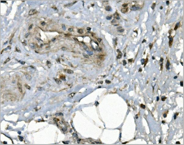 product-image-AAA19249_IHC2.jpg
