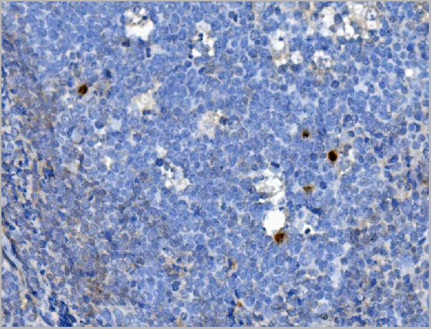 product-image-AAA19249_IHC6.jpg