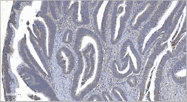 product-image-AAA19256_IHC2.jpg