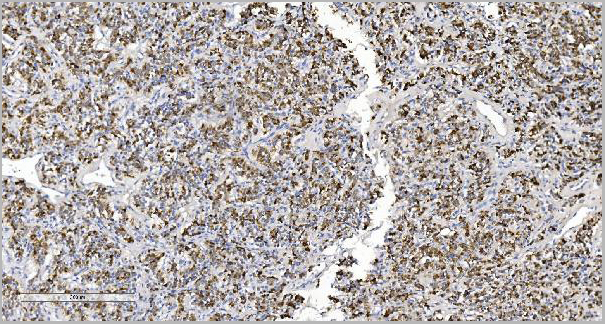 product-image-AAA19256_IHC3.jpg