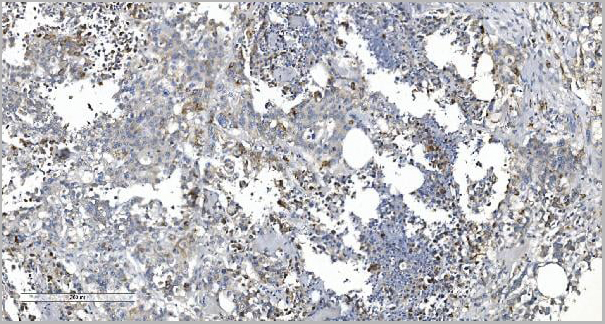 product-image-AAA19256_IHC4.jpg
