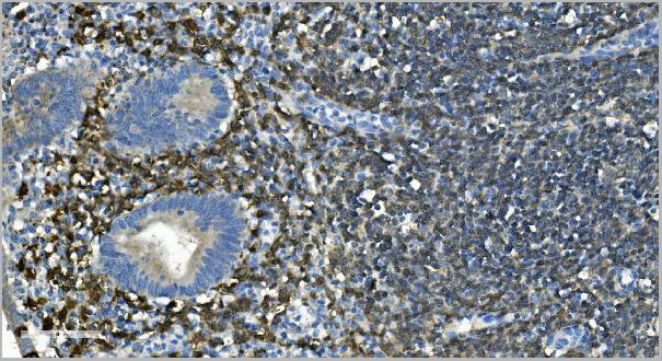 product-image-AAA19281_IHC2.jpg