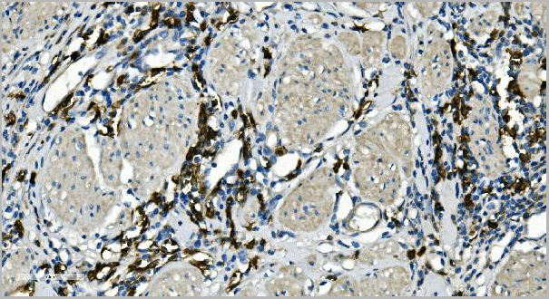 product-image-AAA19281_IHC3.jpg