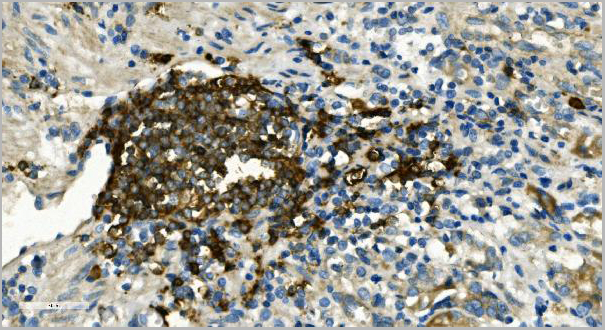 product-image-AAA19281_IHC4.jpg