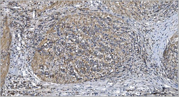 product-image-AAA19302_IHC2.jpg