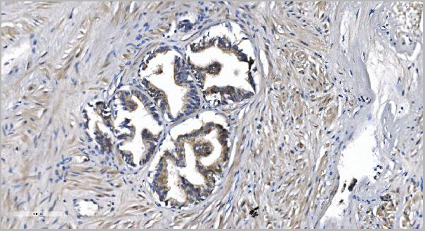 product-image-AAA19302_IHC3.jpg