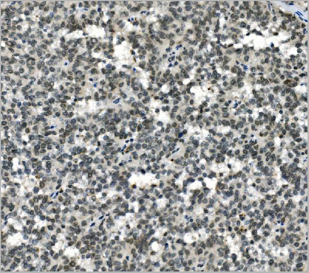 product-image-AAA19334_IHC2.jpg