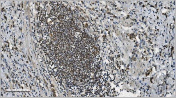 product-image-AAA19345_IHC3.jpg