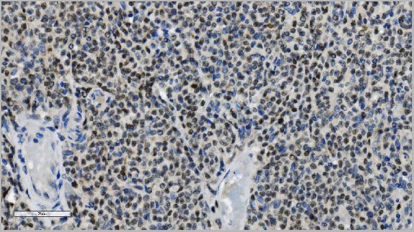 product-image-AAA19345_IHC7.jpg