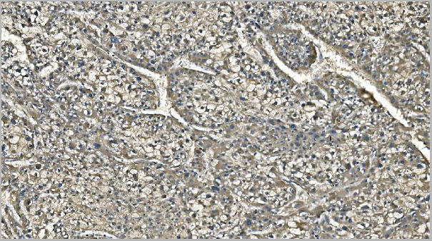 product-image-AAA19347_IHC3.jpg