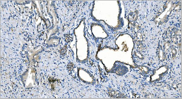 product-image-AAA19347_IHC5.jpg