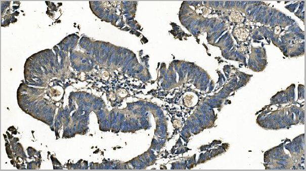 product-image-AAA19347_IHC6.jpg
