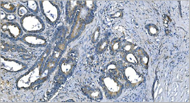 product-image-AAA19348_IHC2.jpg