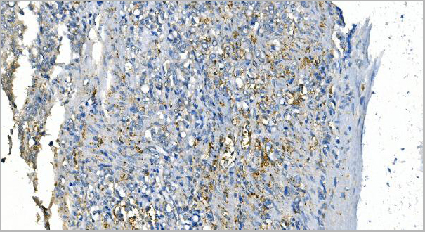 product-image-AAA19348_IHC3.jpg
