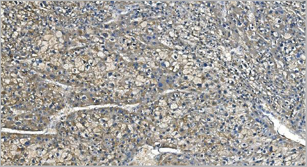 product-image-AAA19348_IHC4.jpg