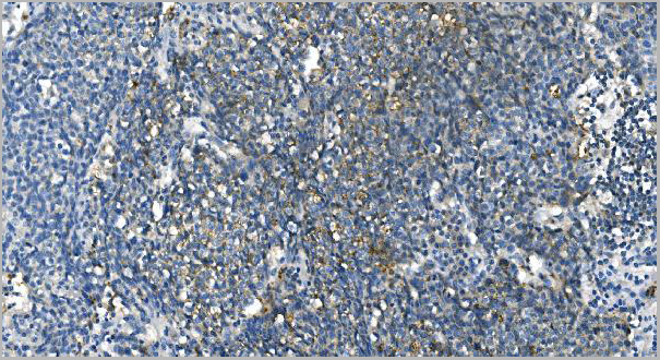 product-image-AAA19348_IHC5.jpg