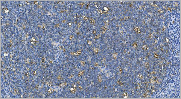 product-image-AAA19348_IHC7.jpg