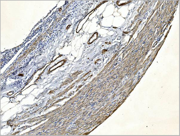 product-image-AAA19352_IHC2.jpg