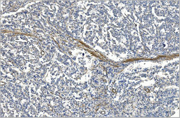 product-image-AAA19352_IHC3.jpg