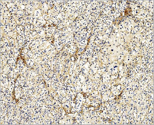 product-image-AAA19352_IHC4.jpg