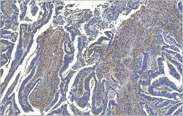 product-image-AAA19352_IHC6.jpg
