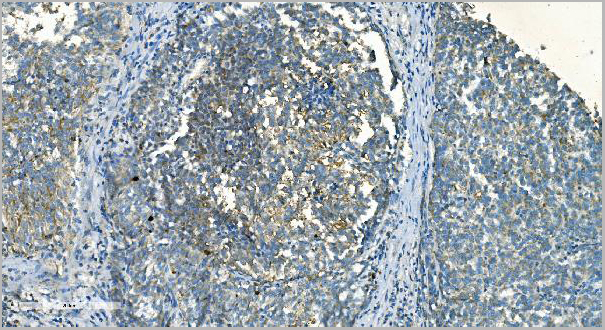 product-image-AAA19353_IHC3.jpg
