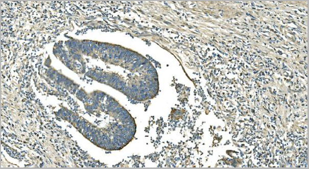 product-image-AAA19354_IHC3.jpg