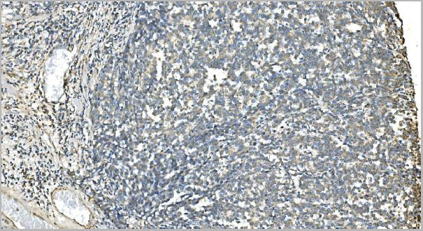 product-image-AAA19354_IHC4.jpg