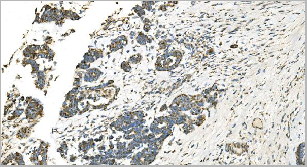 product-image-AAA19354_IHC5.jpg